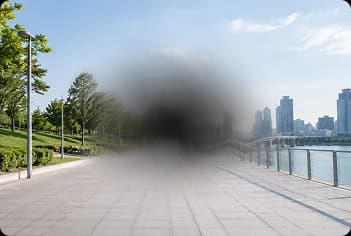 황반변성, 검사와 치료 시기를 놓치면 시력 저하가 진행될 수 있습니다