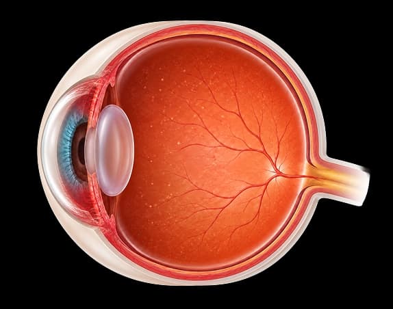 Uveitis